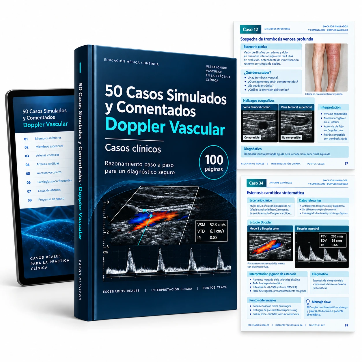 Mockup digital: 50 Casos Simulados y Comentados de Doppler Vascular