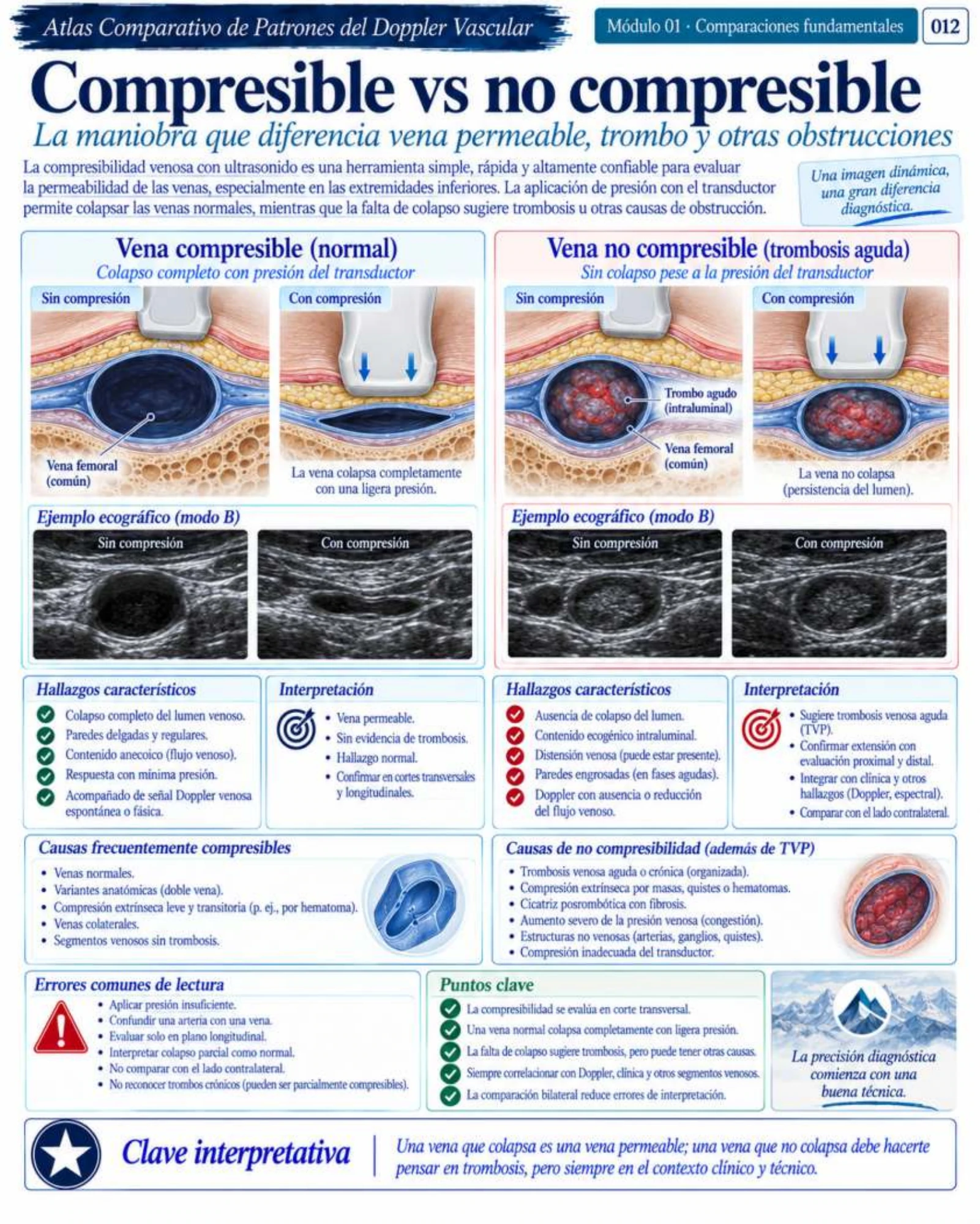 Página 12: Compresible vs. no compresible. Muestra del material digital de Doppler vascular.