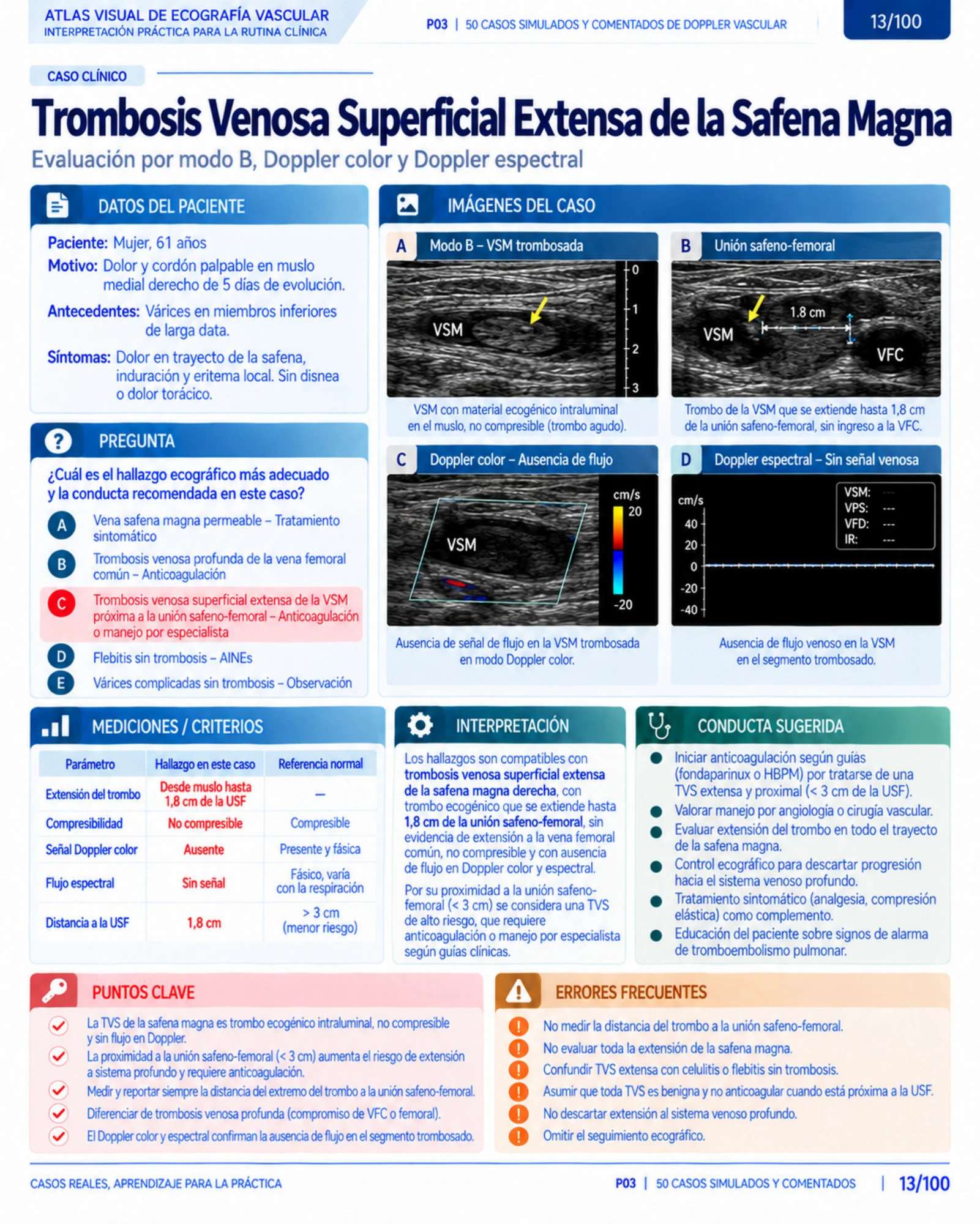 Página 13: Caso: trombosis venosa superficial. Muestra del material digital de Doppler vascular.