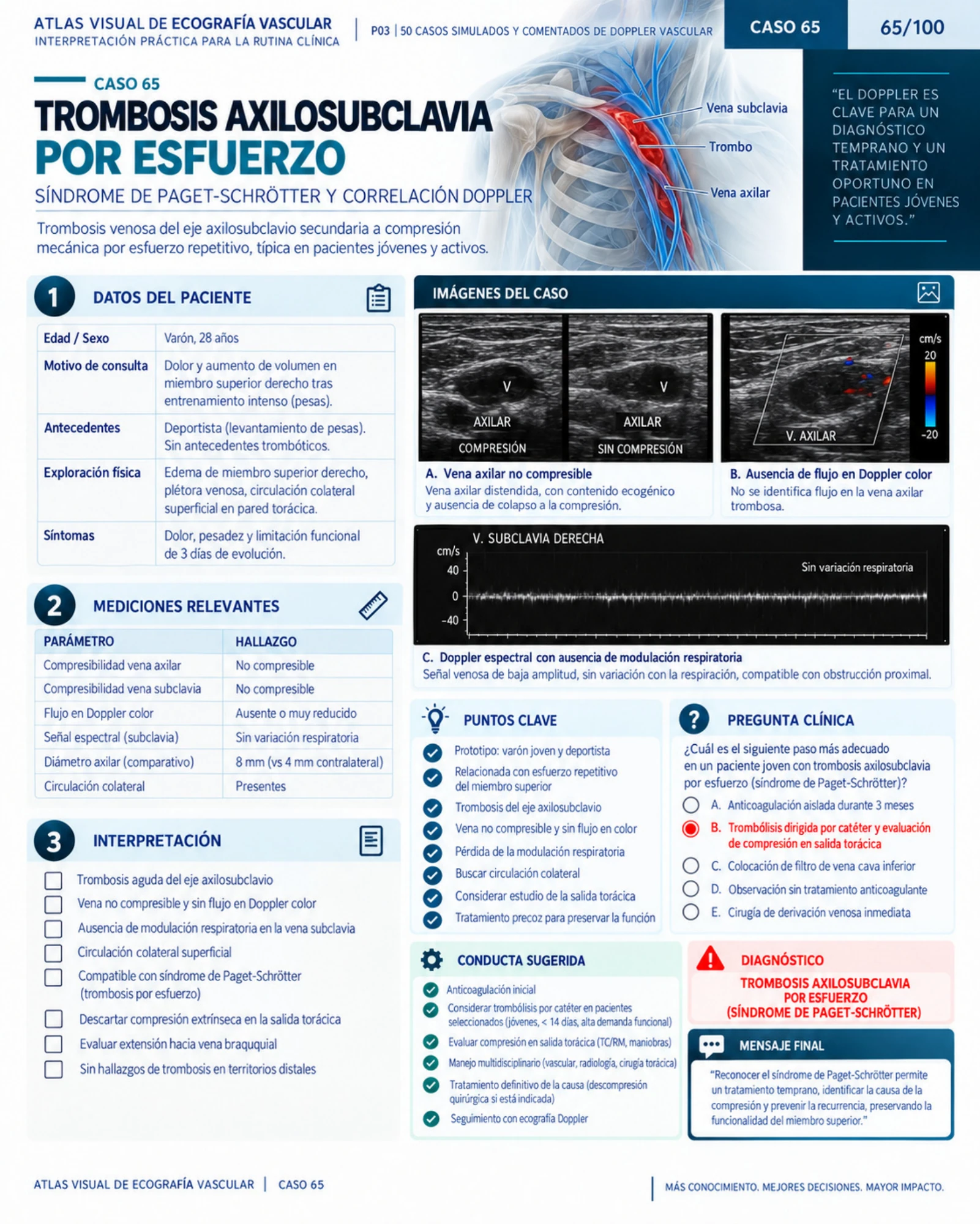 Página 65: Caso: trombosis axilosubclavia. Muestra del material digital de Doppler vascular.