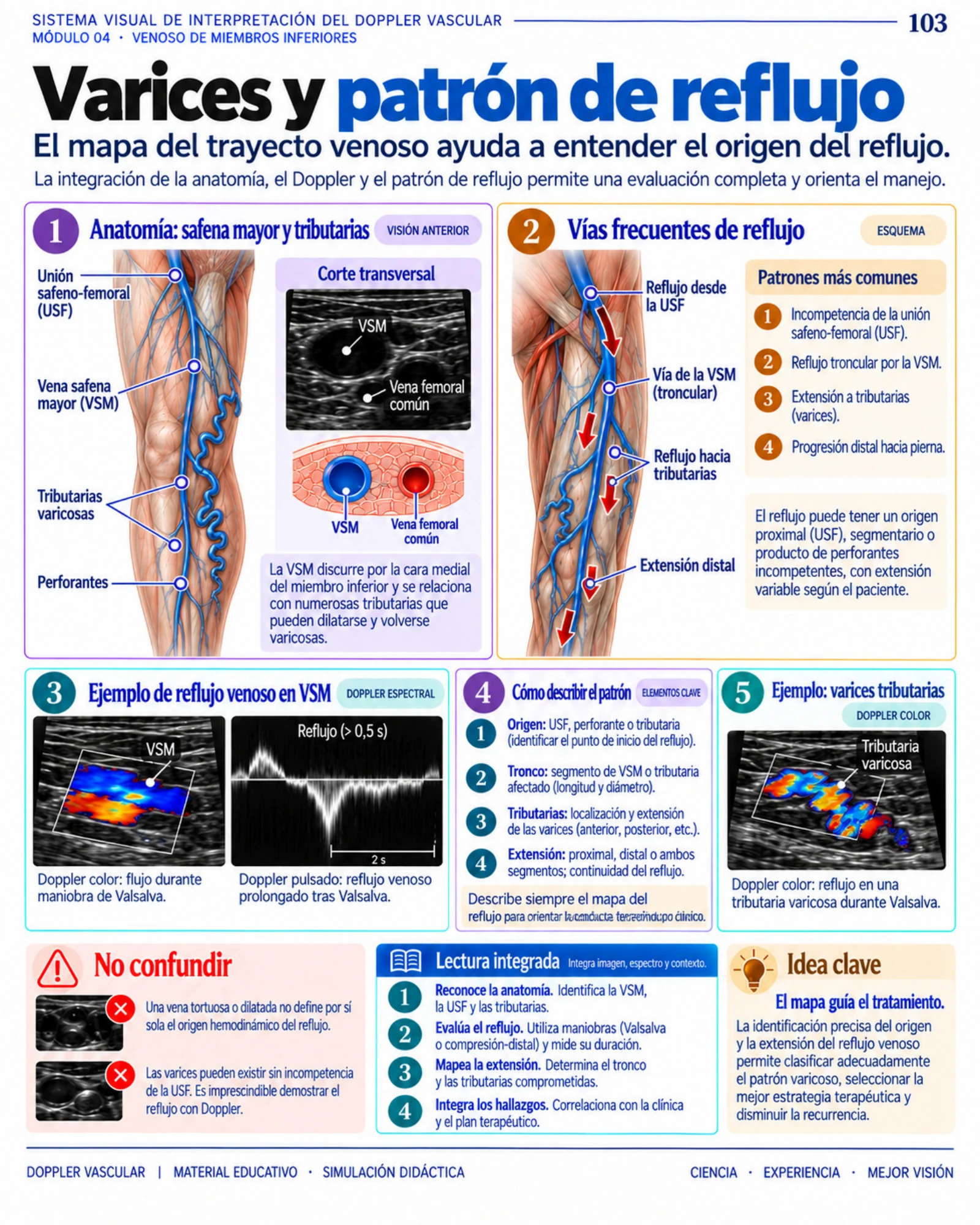 Página 103: Varices y patrón de reflujo. Muestra del material digital de Doppler vascular.